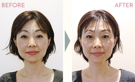 クラニアル整顔セラピービフォーアフター画像