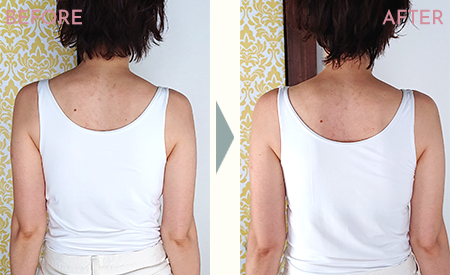 クラニアル整顔セラピービフォーアフター画像