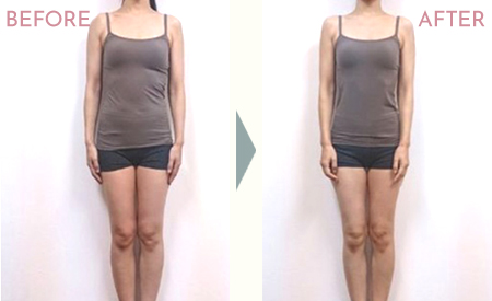 クラニアル整顔セラピービフォーアフター画像